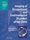 Imaging of Occupational and Environmental Disorders of the Chest
