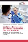 Lesiones bucales en pacientes infectados por el VIH -SIDA