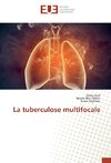 La tuberculose multifocale