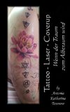 Tattoo - Laser - Cover Up