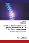 Travma pozvonochnika v rentgenovskom, KT i MRT issledovanii