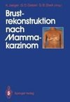 Brustrekonstruktion nach Mammakarzinom