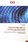 Tomoscintigraphie à l'111In-pentétréotide