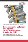 Detección del volumen del líquido Cefalorraquídeo a través de MRI