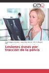 Lesiones óseas por tracción de la pelvis