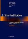 In Vitro Fertilization