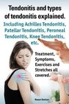 Tendonitis and the Different Types of Tendonitis Explained. Tendonitis Symptoms, Diagnosis, Treatment Options, Stretches and Exercises All Included.