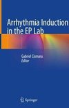 Arrhythmia Induction in the EP Lab