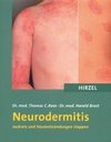 Neurodermitis