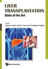 Liver Transplantation