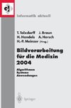 Bildverarbeitung für die Medizin 2004