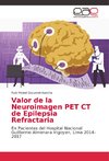 Valor de la Neuroimagen PET CT de Epilepsia Refractaria