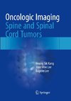 Oncologic Imaging: Spine and Spinal Cord Tumors