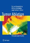 Tumor Ablation