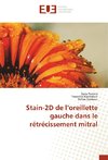 Stain-2D de l'oreillette gauche dans le rétrécissement mitral