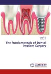 The Fundamentals of Dental Implant Surgery