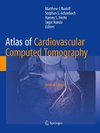 Atlas of Cardiovascular Computed Tomography