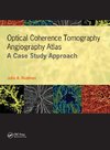 Optical Coherence Tomography Angiography Atlas