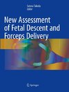 New Assessment of Fetal Descent and Forceps Delivery