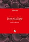 Carotid Artery Disease