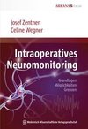 Intraoperatives Neuromonitoring