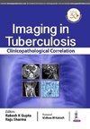 Imaging in Tuberculosis