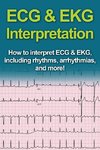 ECG & EKG Interpretation