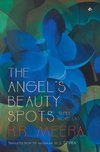 The Angel's Beauty Spots