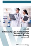 Erkennung von Hirntumoren mittels digitaler Bildverarbeitung