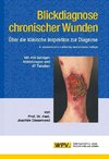 Blickdiagnose chronischer Wunden