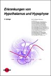 Erkrankungen von Hypothalamus und Hypophyse