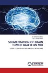 SEGMENTATION OF BRAIN TUMOR BASED ON MRI