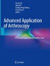 Advanced Application of Arthroscopy