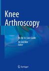 Knee Arthroscopy