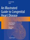 An Illustrated Guide to Congenital Heart Disease