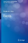 Uveitis