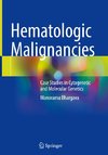 Hematologic Malignancies