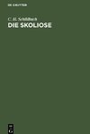 Die Skoliose