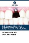 OKKLUSION BEI IMPLANTATEN