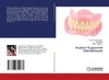 Implant Supported Overdentures