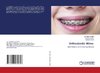 Orthodontic Wires