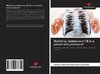 Multidrug resistance of TB in a patient and process of