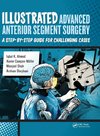 Illustrated Advanced Anterior Segment Surgery