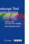 Endoscopic Third Ventriculostomy