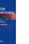 Radionuclide Parathyroid Imaging