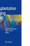 Transplantation Imaging