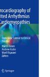 Electrocardiography of Inherited Arrhythmias and Cardiomyopathies