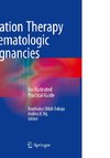 Radiation Therapy in Hematologic Malignancies