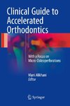 Clinical Guide to Accelerated Orthodontics