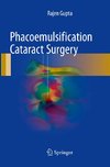 Phacoemulsification Cataract Surgery